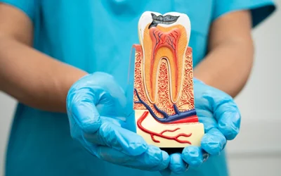 Root Canal Treatment